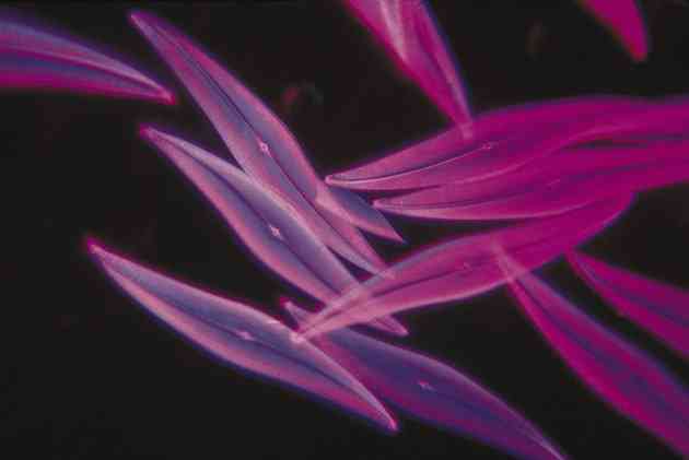 Peligros de los suplementos de fitoplancton (2)